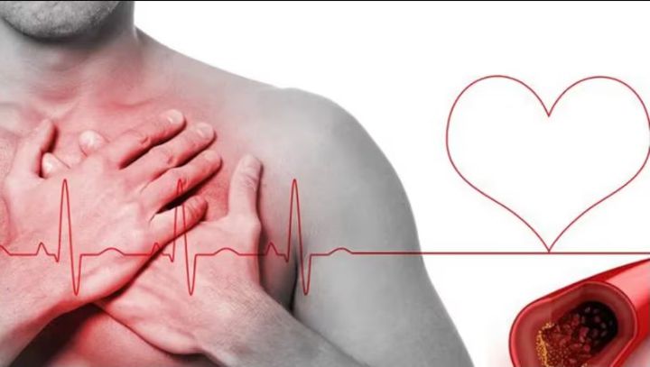 Síndrome de diciembre: por qué en las Fiestas aumenta el riesgo cardíaco