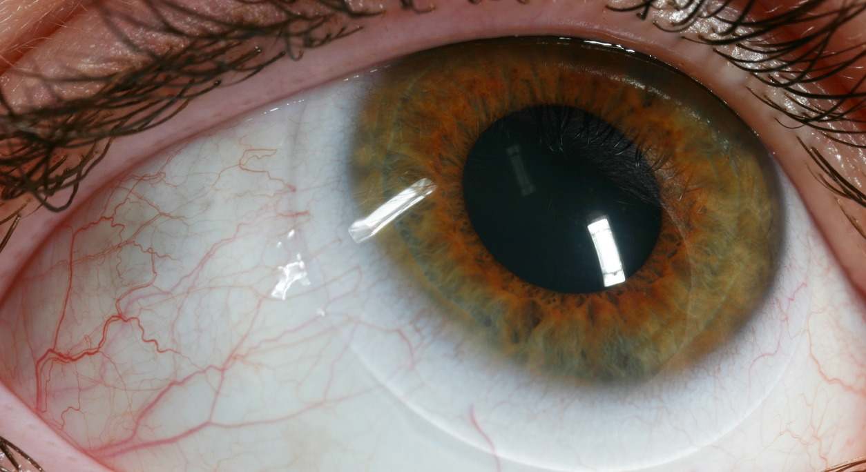 Orgullo argentino: médicos premiados por una cirugía que reconstruyó un ojo y devolvió la visión