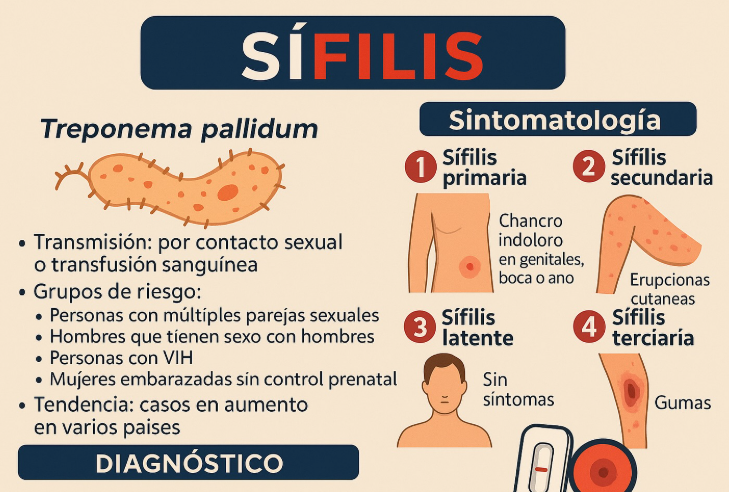 Récord histórico de casos de sífilis en Argentina: alertan por un aumento sostenido y piden reforzar la prevención